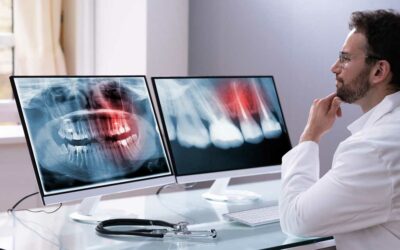 Strategic Advantages of Collaborating with XDental: Reduced Time, Lower Costs, and High Customization